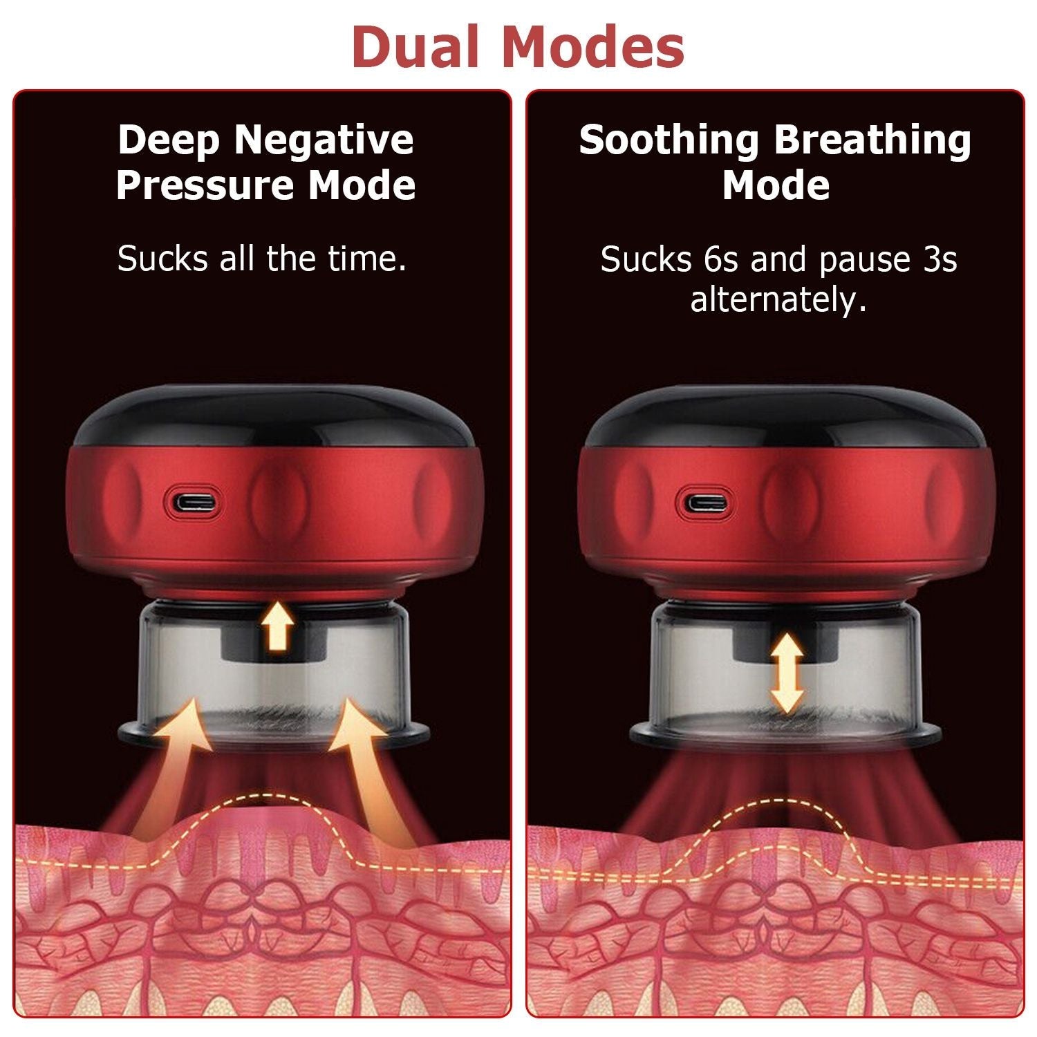 Electric Cupping Therapy Massage - Vacuum Therapy Cupping Therapy Device /Temperature and Suction